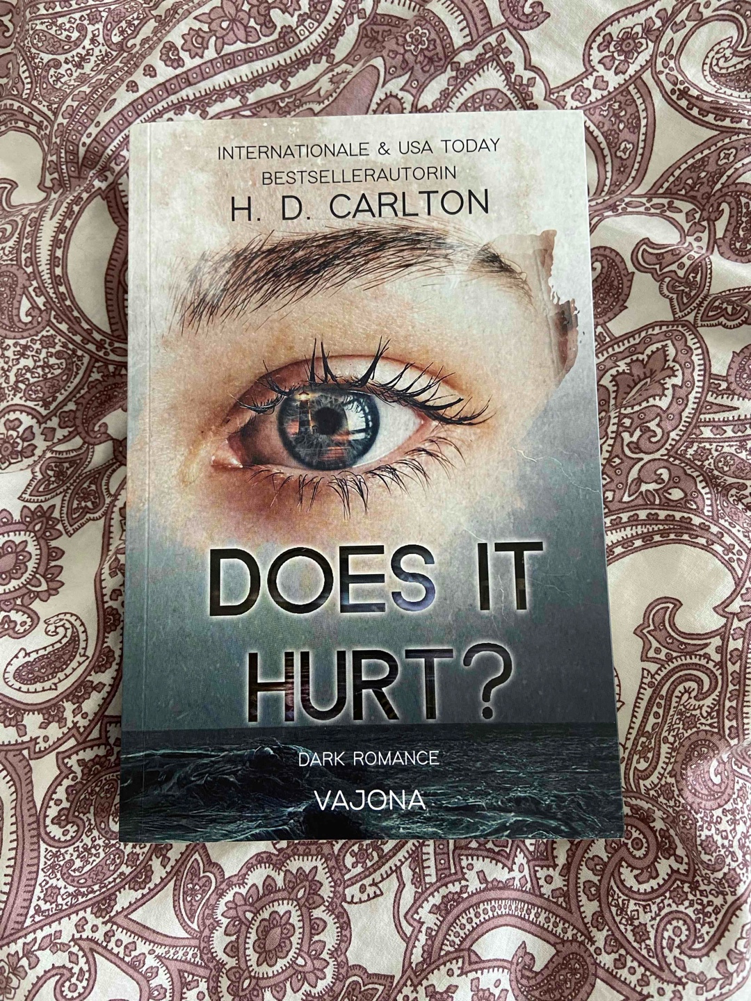 Does it hurt? 🦈